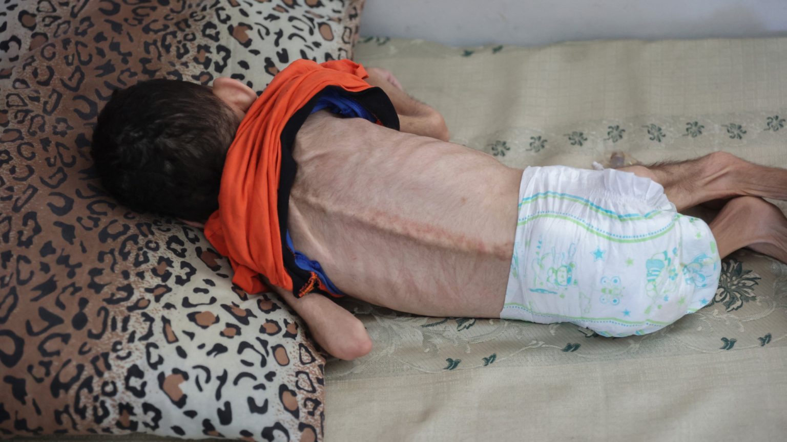 الحرب على غزة: خطر المجاعة لا يزال قائما حيث يتضور نصف مليون شخص جوعا، كما يرى المراقب