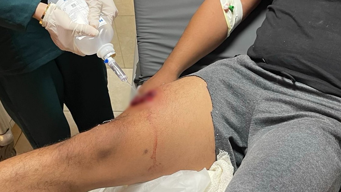 يتلقى أحمد سيسون* العلاج من إصابته بطلق ناري في نابلس في 9 أغسطس 2024.