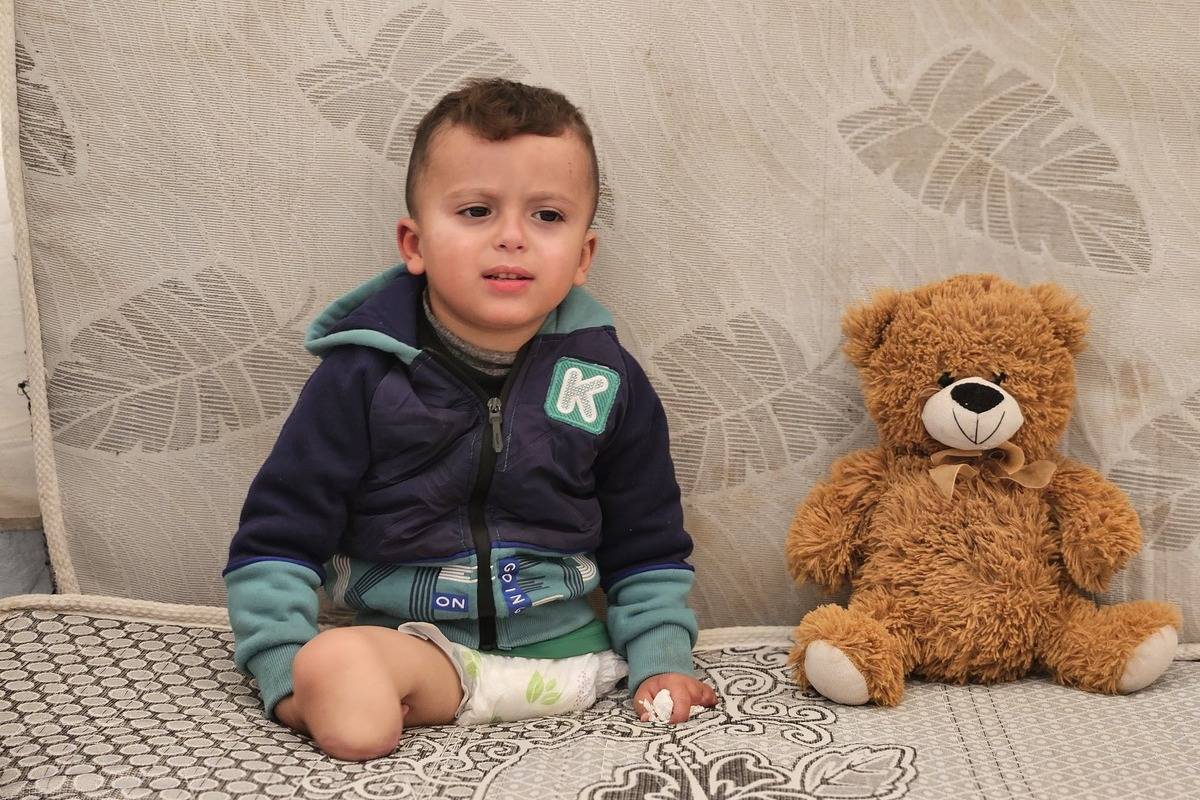 جهاد محمود، طفل فلسطيني يبلغ من العمر 3 سنوات، فقد ساقيه و3 أصابع في الهجمات الإسرائيلية، يكافح من أجل العيش في خيمة في ظل ظروف صعبة في منطقة المواصي بخانيونس، غزة، 4 يناير 2025. (هاني الشاعر - وكالة الأناضول)