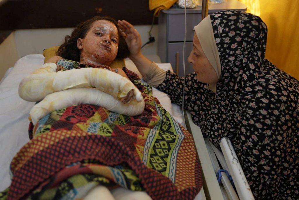 الأطباء بلا حدود: 70 ٪ من ضحايا الحرق في غزة أطفال
