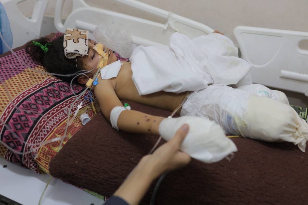 يواجه مبتوريات غزة الحياة في منطقة حرب مع القليل من المعاملة ، وحتى أقل أمل