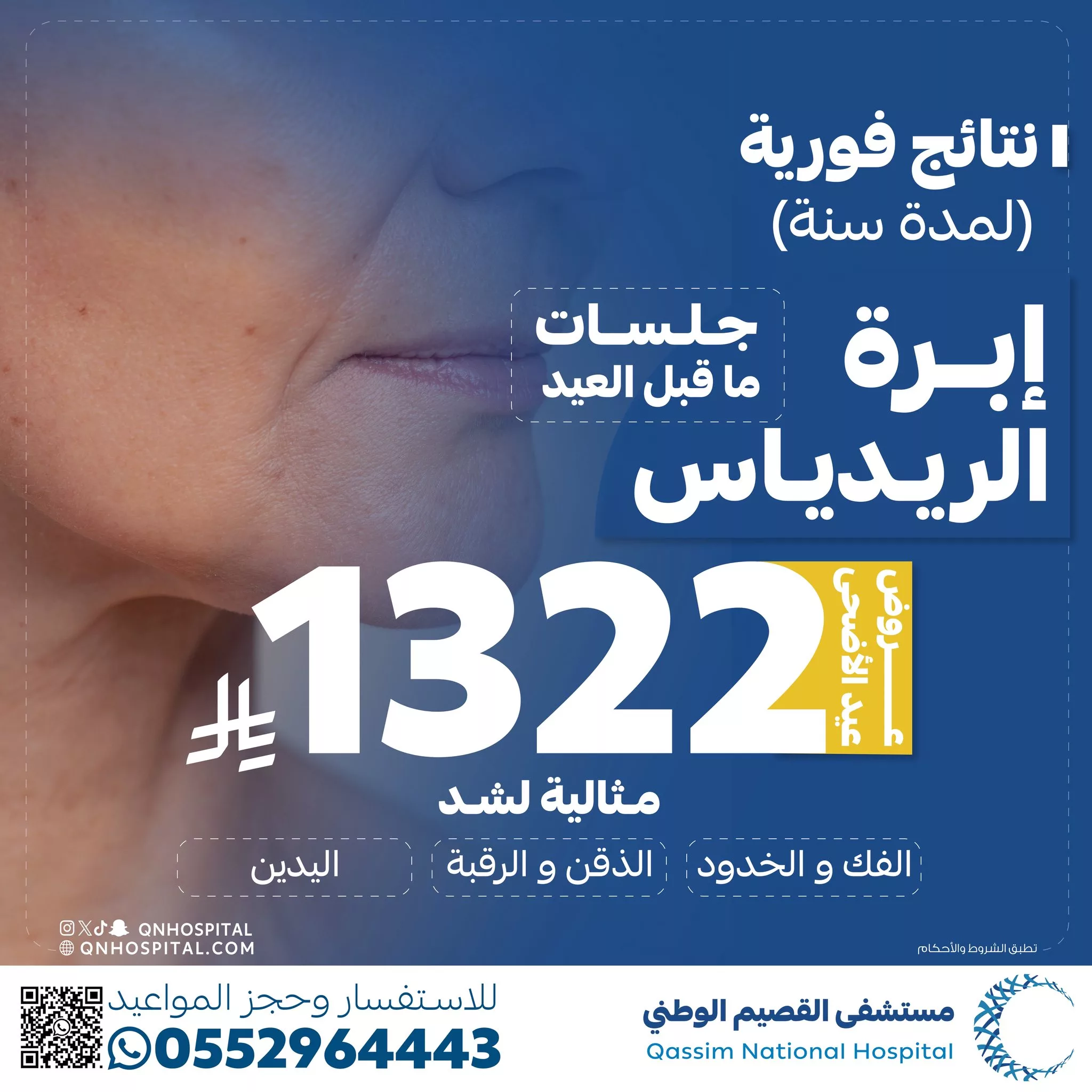 عروض تجميلية مميزة بمستشفى القصيم الوطني بمناسبة عيد الأضحى 4 2 167 - عروض تجميلية مميزة بمستشفى القصيم الوطني بمناسبة عيد الأضحى