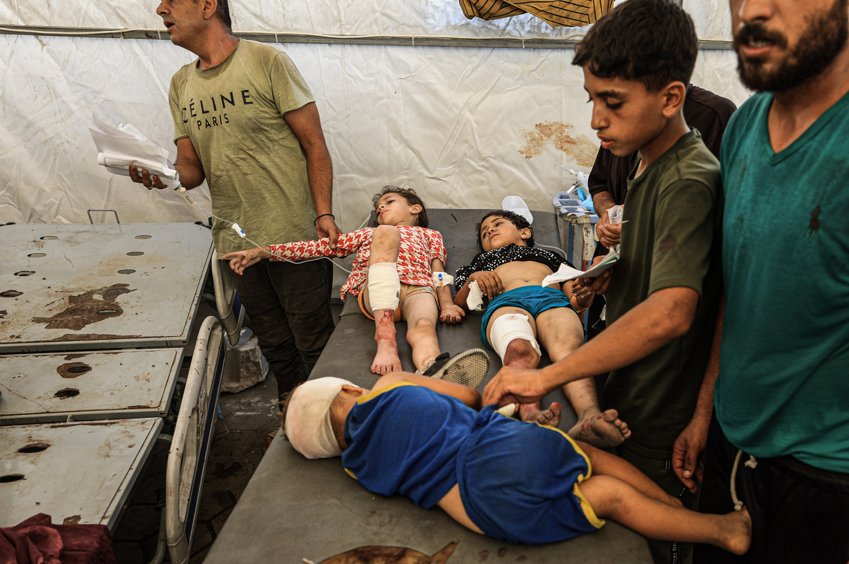 يتم إحضار الفلسطينيين المصابين ، بما في ذلك الأطفال إلى المستشفى المعمدانيين المعمدانيين لآثار العلاج الطبي للهجوم الإسرائيلي على مدينة غزة ، غزة في 16 يوليو 2025 (داود أبو ألكاس - وكالة أندمولو)