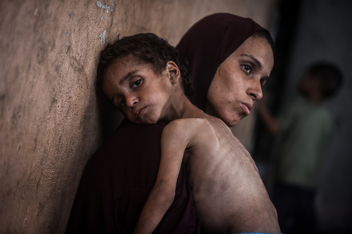 شوهد مع والدته في معسكر اللاجئين في غزة في 24 يوليو 2025 (علي جاد الله-وكالة أنادولو) في غزة قطاع غزة في 24 يوليو 2025 (علي جاد الله-وكالة أنادولو) في معسكر اللاجئين في غزة في 24 يوليو 202 أن ينظر إلى يزين يزاحت إن صحبة