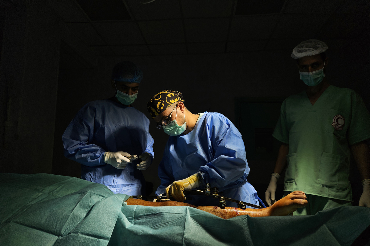 الأطباء الفلسطينيون في مستشفى الهلال الأحمر الفلسطيني إلى جانب فريق طبي بريطاني ينقذون حياة الفلسطينيين الذين أصيبوا في هجمات إسرائيلية على الرغم من موارد محدودة في خان يونيس ، غزة في 18 يوليو 2025.