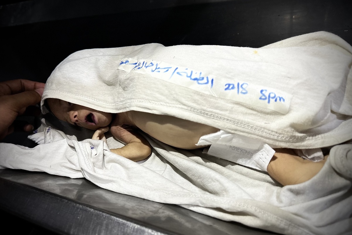 يتم إحضار جثة من الطفل الفلسطيني البالغ من العمر شهرين ، راسل إوبو ميسود ، الذي فقد حياته بسبب سوء التغذية ، إلى مستشفى ناصر لعملية الجنازة مع استمرار الحصار الغذائي الإسرائيلي في خان يونيس ، غزة في 22 أغسطس 2025 (هاني الشاير-وكالة Anadolu)