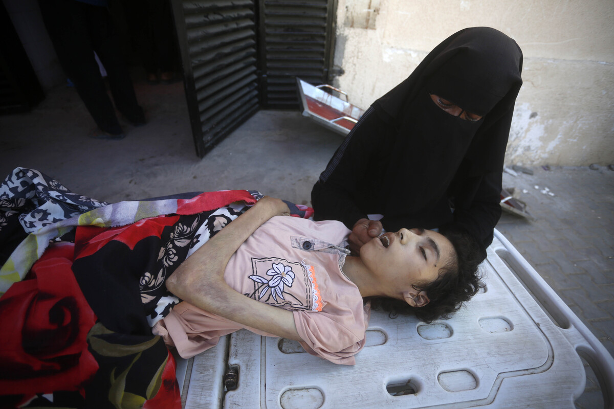 شايما العشريم ، الفلسطينية البالغة من العمر 20 عامًا ، توفي بسبب سوء التغذية في قطاع غزة ، حيث تقصرت الحصار المفروضة على إسرائيل وقيودهم في مستشفى شهيد القاعدة في عام 31 أغسطس ، (موهام ناصري).