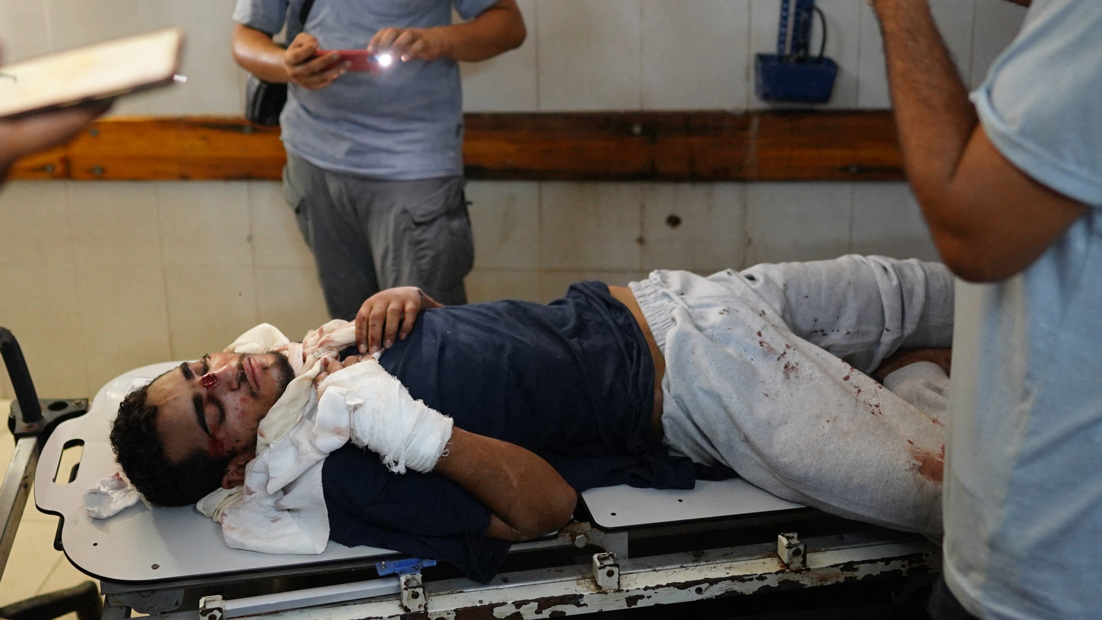 رجل فلسطيني فاوزي عبد العلم ، 21 عامًا ، يتلقى علاجًا لإصاباته في مستشفى ناصر في خان يونس ، جنوب غزة ، بعد إطلاقه من الاحتجاز الإسرائيلي (AFP/Bashar Taleb)