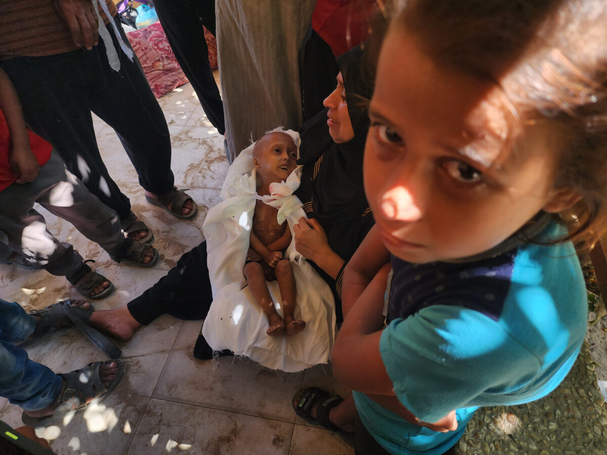 أحضر أقارب وأحباء من الفلسطينيين الفلسطينيين البالغة من العمر 4 سنوات حفلها الجنائزي بعد أن فقدت حياتها بسبب سوء التغذية ، وافتقار الأدوية ، والحصار ، الذي منعها من السفر إلى الخارج للعلاج في خان يونيس ، غزة في 1 سبتمبر 2025.