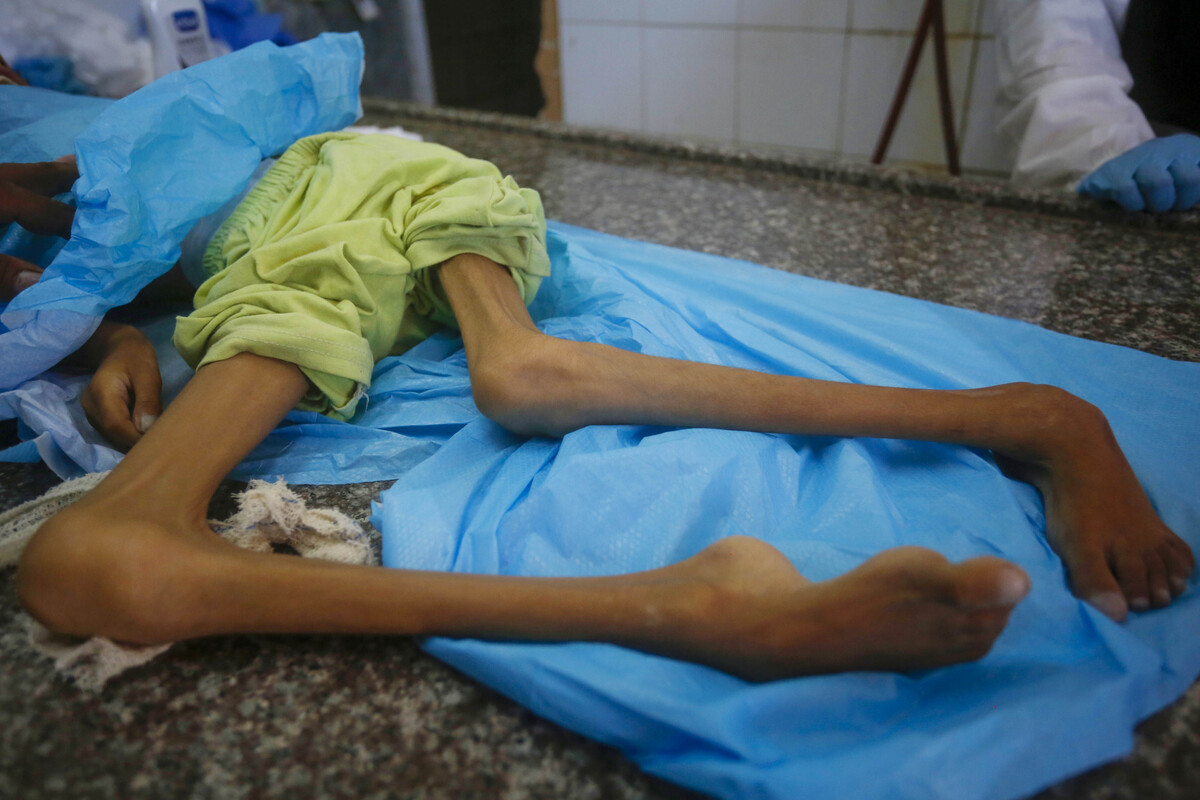 تم إحضار جثة الفتاة الفلسطينية البالغة من العمر 10 سنوات أمين ماروف ، التي توفيت بسبب سوء التغذية في قطاع غزة المحصور ، إلى مستشفى الشهداء في العقيدة في دير البلا لإجراءات الجنازة في 12 سبتمبر 2025. (محمد ناسار-وكالة Anadolu)