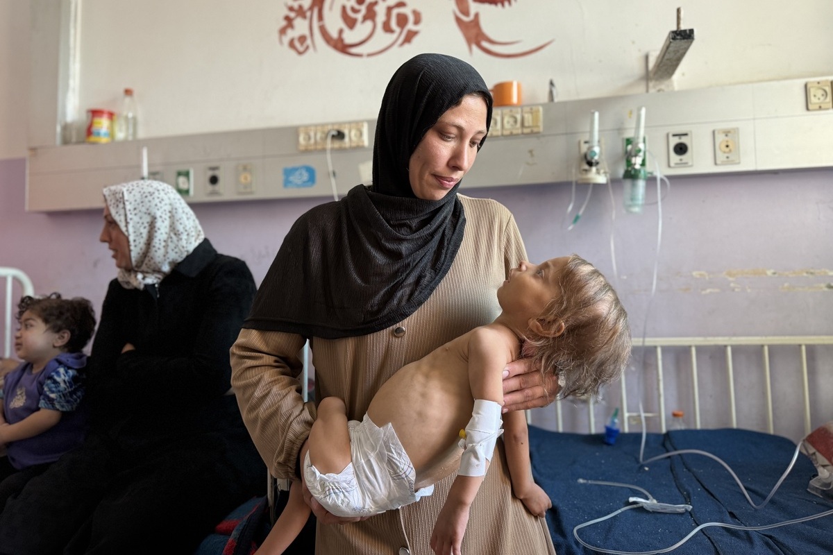 الطفلة الفلسطينية ميرا حاتم أبو أخضر البالغة من العمر أربع سنوات ترقد في حالة حرجة بسبب سوء التغذية في مستشفى شهداء الأقصى في دير البلح بغزة، 2 أكتوبر 2025. (علاء يم أبو محسن – وكالة الأناضول)