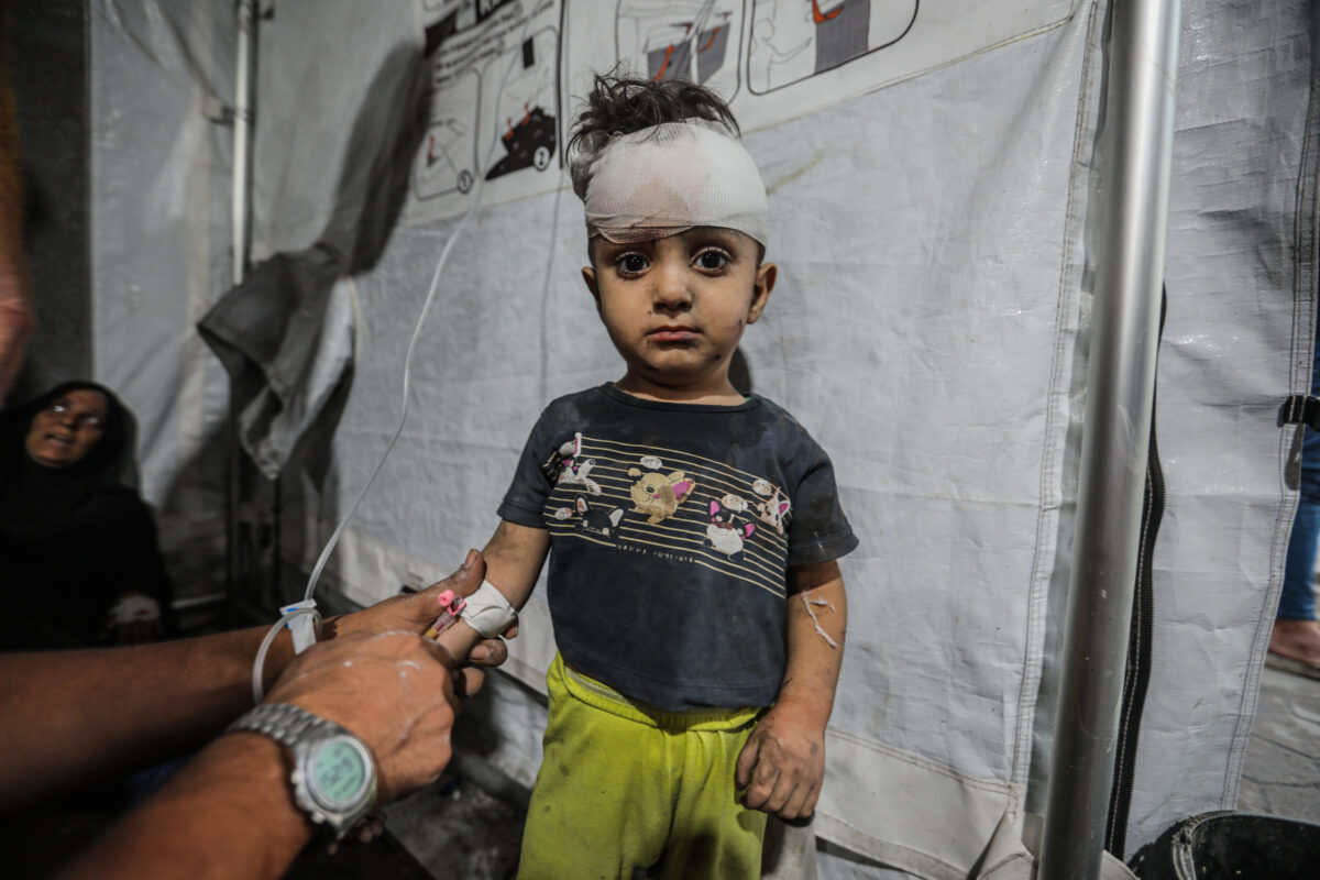 يتم إحضار الأطفال الفلسطينيين المصابين إلى مستشفى الأهلي لتلقي العلاج الطبي بعد الهجوم الإسرائيلي في حي الطفاه في مدينة غزة ، غزة في 4 أكتوبر 2025.