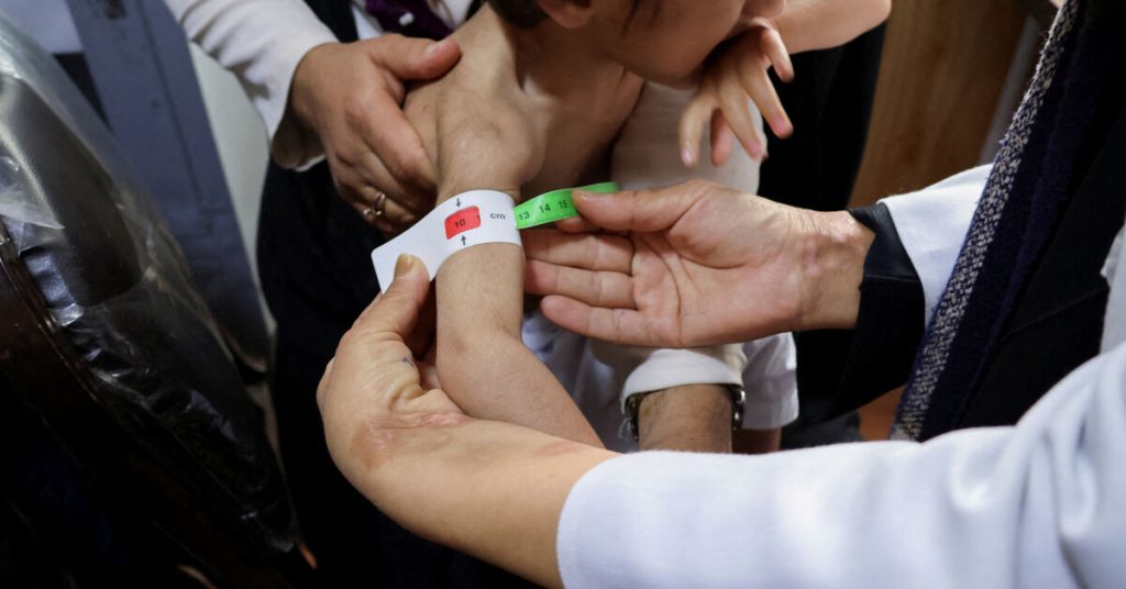 تتفاقم أزمة الجوع في أفغانستان مع نقص التمويل الإغاثي، حسبما أفادت الأمم المتحدة.